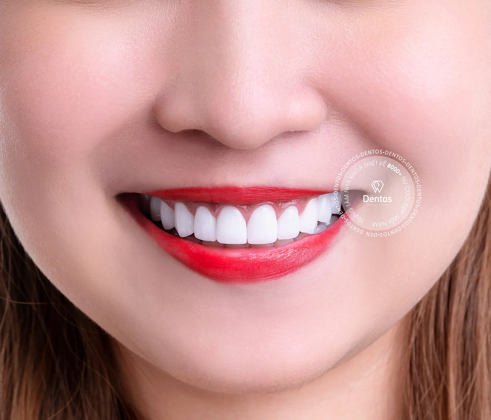 Răng sứ Zirconia có giá thành mềm nhất trong các loại răng toàn sứ